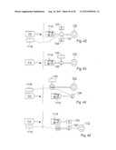 METHOD FOR THE TREATMENT OF GALLSTONES diagram and image