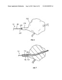 LOW-PROFILE INTRALUMINAL LIGHT DELIVERY SYSTEM AND METHODS OF USING THE     SAME diagram and image