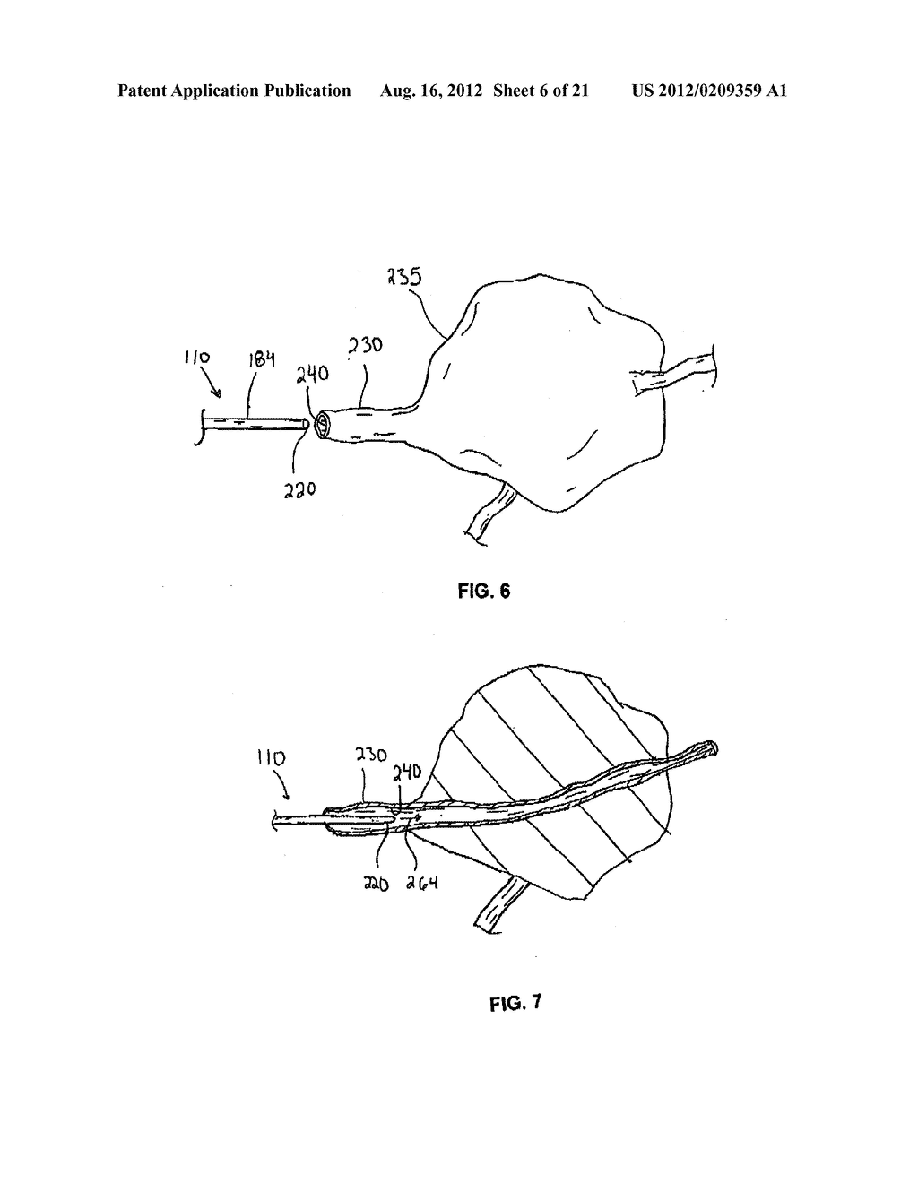 LOW-PROFILE INTRALUMINAL LIGHT DELIVERY SYSTEM AND METHODS OF USING THE     SAME - diagram, schematic, and image 07