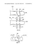 LOW-PROFILE INTRALUMINAL LIGHT DELIVERY SYSTEM AND METHODS OF USING THE     SAME diagram and image