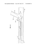 BIFURCATION CATHETER DUAL BALLOON BOND AND METHODS diagram and image