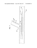 BIFURCATION CATHETER DUAL BALLOON BOND AND METHODS diagram and image