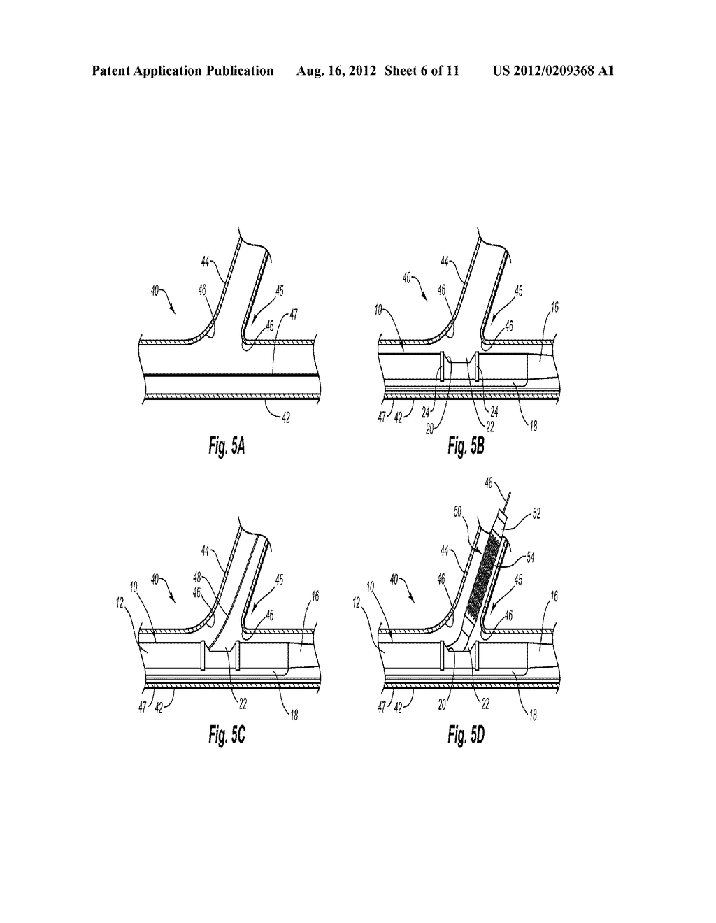 SYSTEM AND METHOD FOR DELIVERING A STENT TO A BIFURCATED VESSEL - diagram, schematic, and image 07
