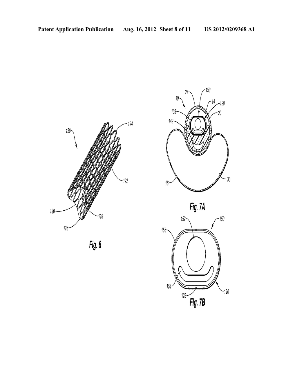 SYSTEM AND METHOD FOR DELIVERING A STENT TO A BIFURCATED VESSEL - diagram, schematic, and image 09