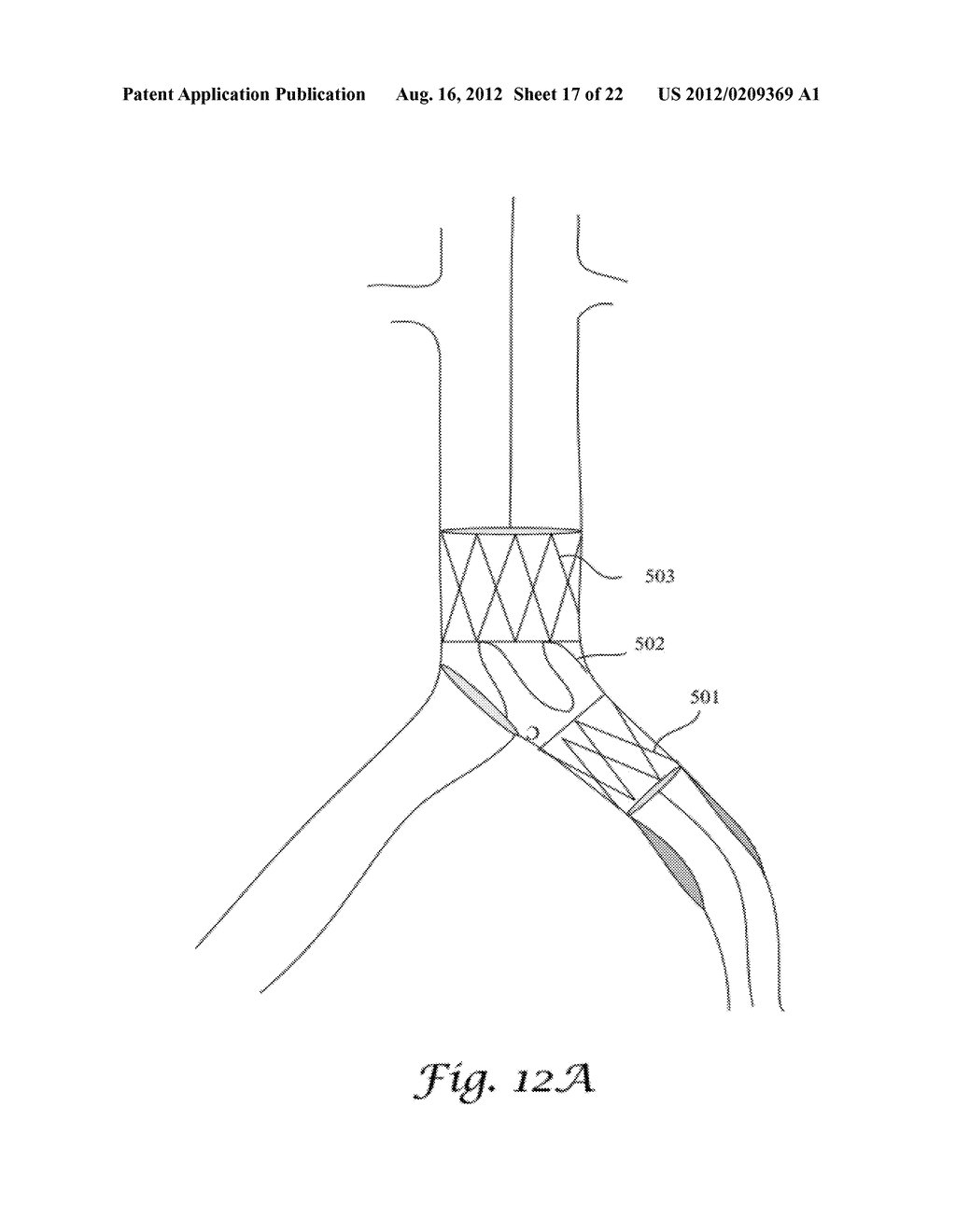 FENESTRATED ENDOGRAFT - diagram, schematic, and image 18