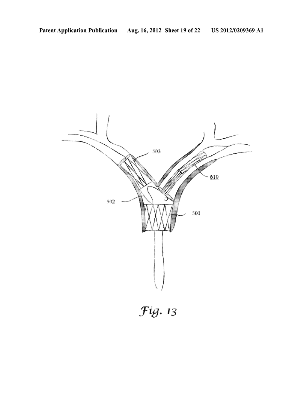 FENESTRATED ENDOGRAFT - diagram, schematic, and image 20