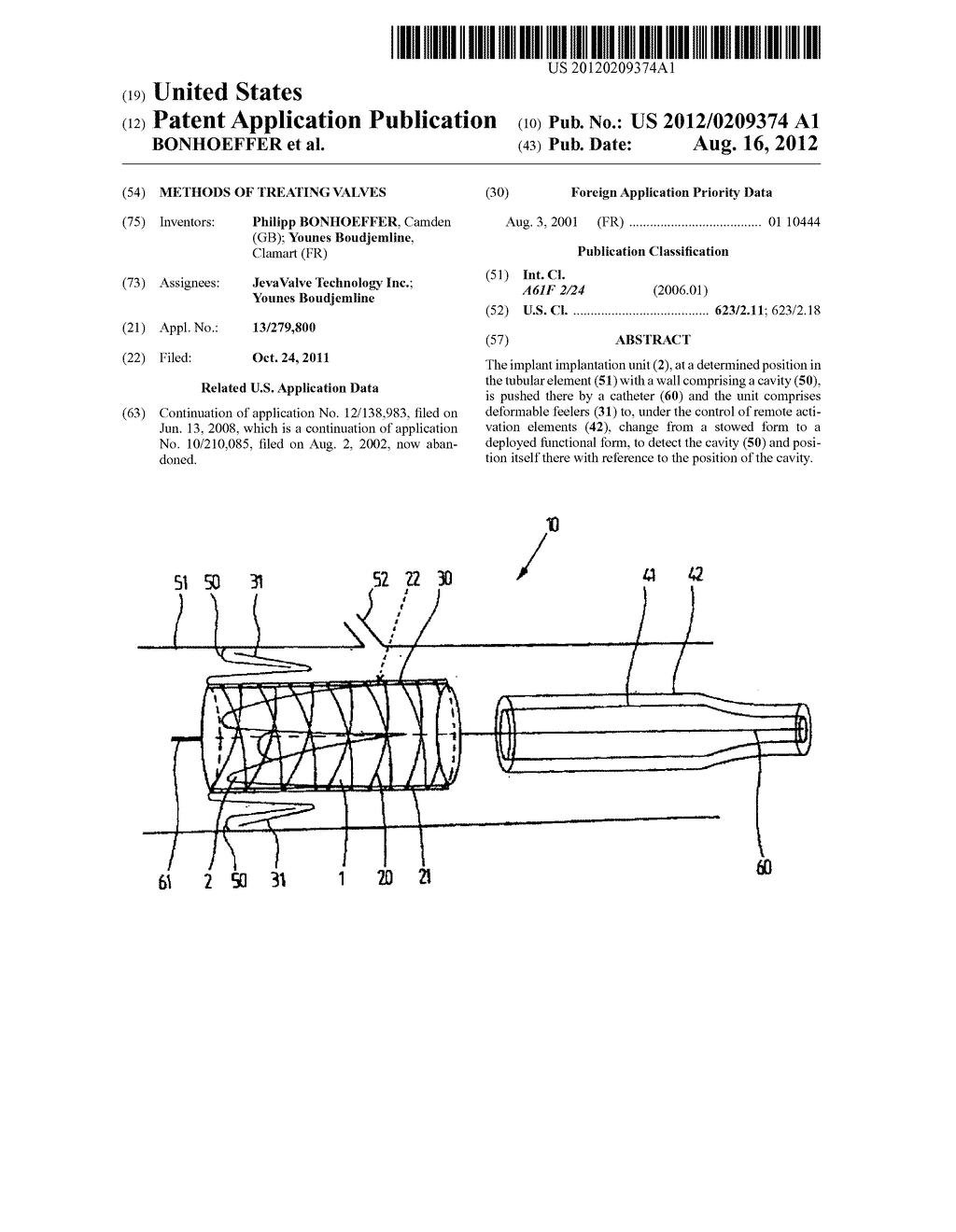 METHODS OF TREATING VALVES - diagram, schematic, and image 01