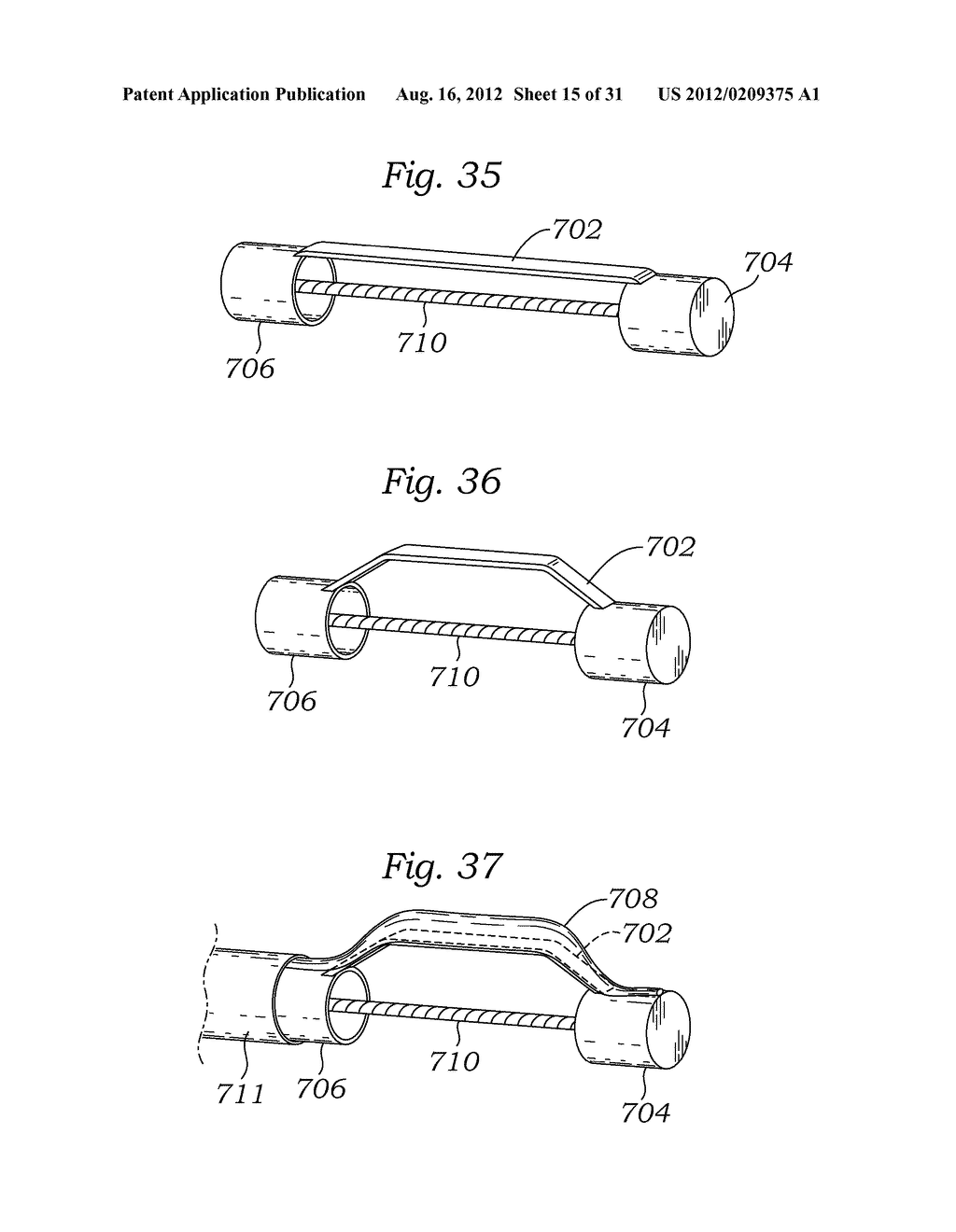 STABILITY DEVICE FOR USE WITH PERCUTANEOUS DELIVERY SYSTEMS - diagram, schematic, and image 16