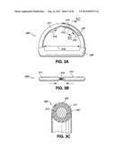 ADJUSTABLE ANNULOPLASTY RING AND ACTIVATION SYSTEM diagram and image