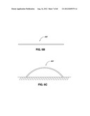 ADJUSTABLE ANNULOPLASTY RING AND ACTIVATION SYSTEM diagram and image