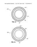 ADJUSTABLE ANNULOPLASTY RING AND ACTIVATION SYSTEM diagram and image