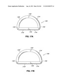 ADJUSTABLE ANNULOPLASTY RING AND ACTIVATION SYSTEM diagram and image