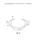 ADJUSTABLE ANNULOPLASTY RING AND ACTIVATION SYSTEM diagram and image