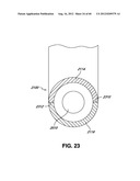 ADJUSTABLE ANNULOPLASTY RING AND ACTIVATION SYSTEM diagram and image