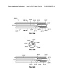 ADJUSTABLE ANNULOPLASTY RING AND ACTIVATION SYSTEM diagram and image