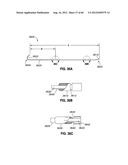 ADJUSTABLE ANNULOPLASTY RING AND ACTIVATION SYSTEM diagram and image