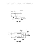 ADJUSTABLE ANNULOPLASTY RING AND ACTIVATION SYSTEM diagram and image