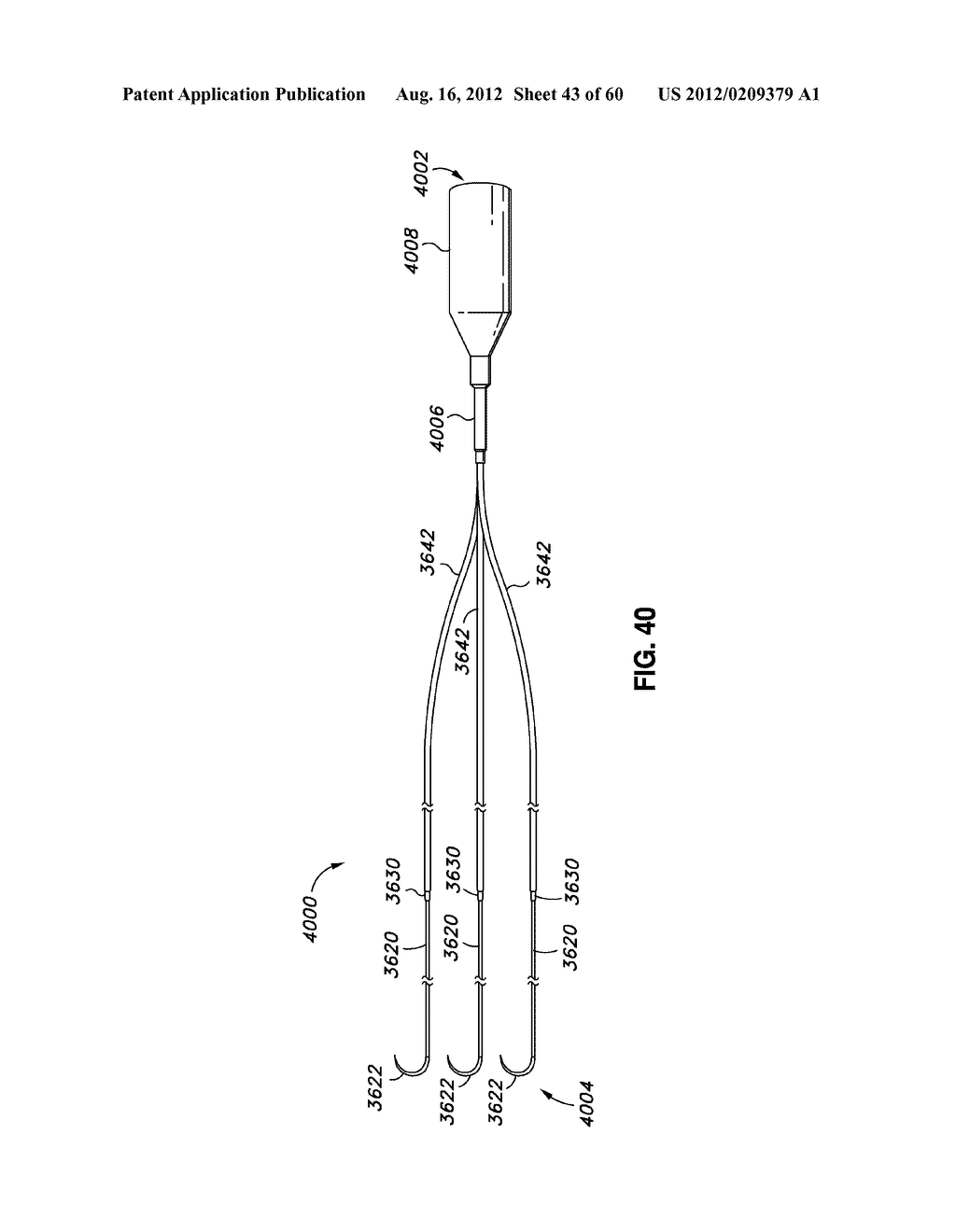 ADJUSTABLE ANNULOPLASTY RING AND ACTIVATION SYSTEM - diagram, schematic, and image 44