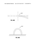 ADJUSTABLE ANNULOPLASTY RING AND ACTIVATION SYSTEM diagram and image