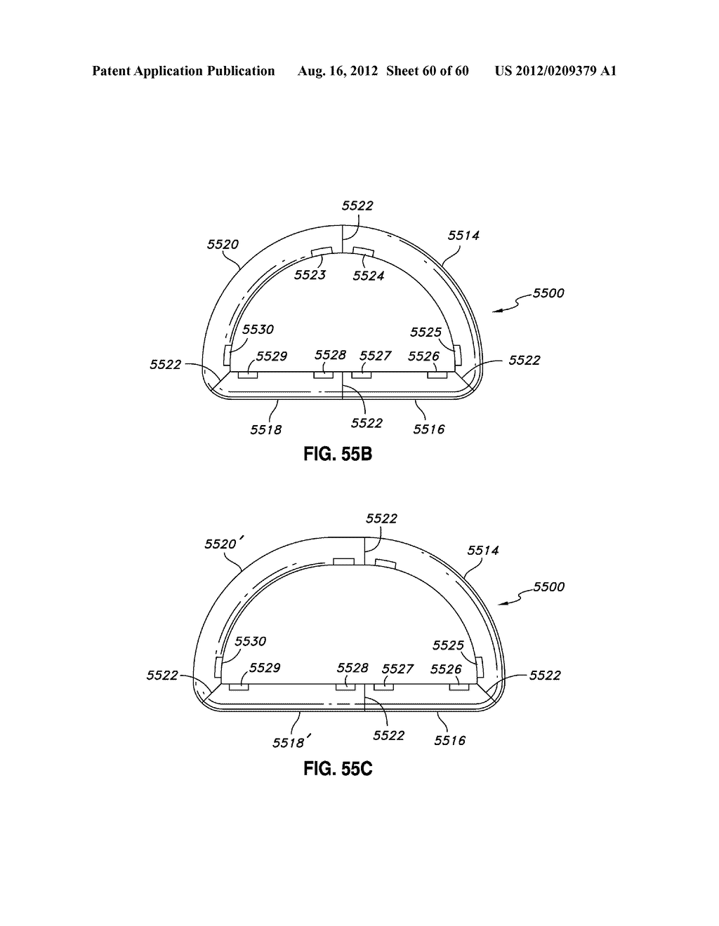 ADJUSTABLE ANNULOPLASTY RING AND ACTIVATION SYSTEM - diagram, schematic, and image 61