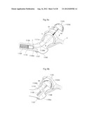 IMPLANTABLE MEDICAL DEVICE AND METHOD OF IMPLANTING THE MEDICAL DEVICE diagram and image