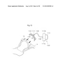 IMPLANTABLE MEDICAL DEVICE AND METHOD OF IMPLANTING THE MEDICAL DEVICE diagram and image