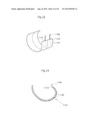 IMPLANTABLE MEDICAL DEVICE AND METHOD OF IMPLANTING THE MEDICAL DEVICE diagram and image