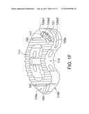 INTERVERTEBRAL CAGE AND IMPLANTING APPARATUS AND OPERATING METHOD THEREOF diagram and image