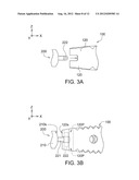 INTERVERTEBRAL CAGE AND IMPLANTING APPARATUS AND OPERATING METHOD THEREOF diagram and image