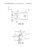 INTERVERTEBRAL CAGE AND IMPLANTING APPARATUS AND OPERATING METHOD THEREOF diagram and image