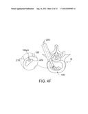 INTERVERTEBRAL CAGE AND IMPLANTING APPARATUS AND OPERATING METHOD THEREOF diagram and image