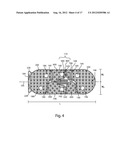 EXPANDABLE INTERVERTEBRAL IMPLANTS AND INSTRUMENTS diagram and image