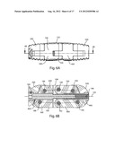 EXPANDABLE INTERVERTEBRAL IMPLANTS AND INSTRUMENTS diagram and image