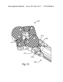 EXPANDABLE INTERVERTEBRAL IMPLANTS AND INSTRUMENTS diagram and image