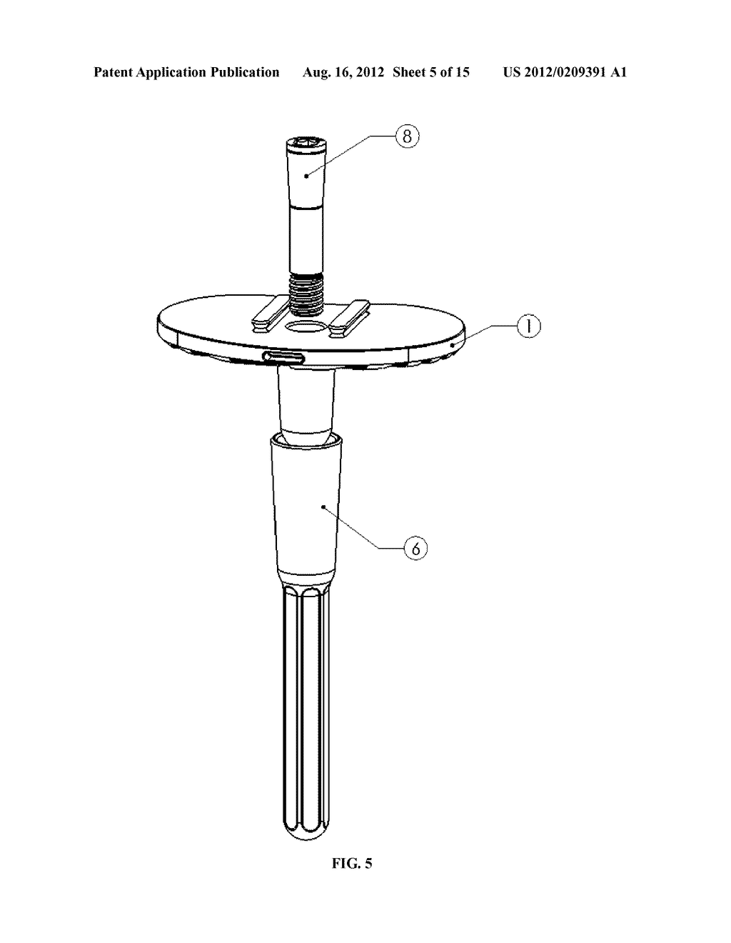 MODULAR PROSTHESIS - diagram, schematic, and image 06