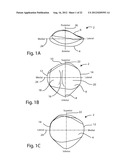 PATELLAR PROSTHESES AND INSTRUMENTATION diagram and image