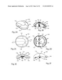 PATELLAR PROSTHESES AND INSTRUMENTATION diagram and image