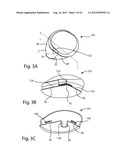 PATELLAR PROSTHESES AND INSTRUMENTATION diagram and image