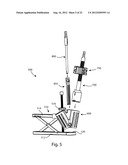 PATELLAR PROSTHESES AND INSTRUMENTATION diagram and image