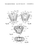 PATELLAR PROSTHESES AND INSTRUMENTATION diagram and image