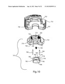 PATELLAR PROSTHESES AND INSTRUMENTATION diagram and image