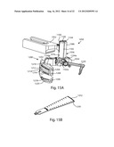 PATELLAR PROSTHESES AND INSTRUMENTATION diagram and image