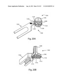 PATELLAR PROSTHESES AND INSTRUMENTATION diagram and image