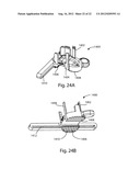 PATELLAR PROSTHESES AND INSTRUMENTATION diagram and image