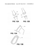 ORTHOPEDIC IMPLANTS HAVING GRADIENT POLYMER ALLOYS diagram and image