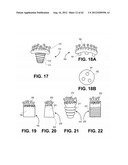 ORTHOPEDIC IMPLANTS HAVING GRADIENT POLYMER ALLOYS diagram and image