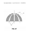 ORTHOPEDIC IMPLANTS HAVING GRADIENT POLYMER ALLOYS diagram and image