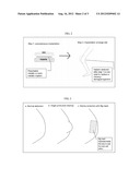 Implant for Tissue Engineering diagram and image