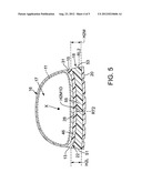 SOLE ASSEMBLY FOR ARTICLE OF FOOTWEAR WITH INTERLOCKING MEMBERS diagram and image