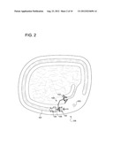 EXTENDABLE JOINTED ARM FOR ENABLING A HAY BALER TO PULL A HAY RAKE DURING     BOTH EASY TRANSPORT AND SIMULTANEOUS OPERATION OF THE HAY BALER AND THE     HAY RAKE diagram and image